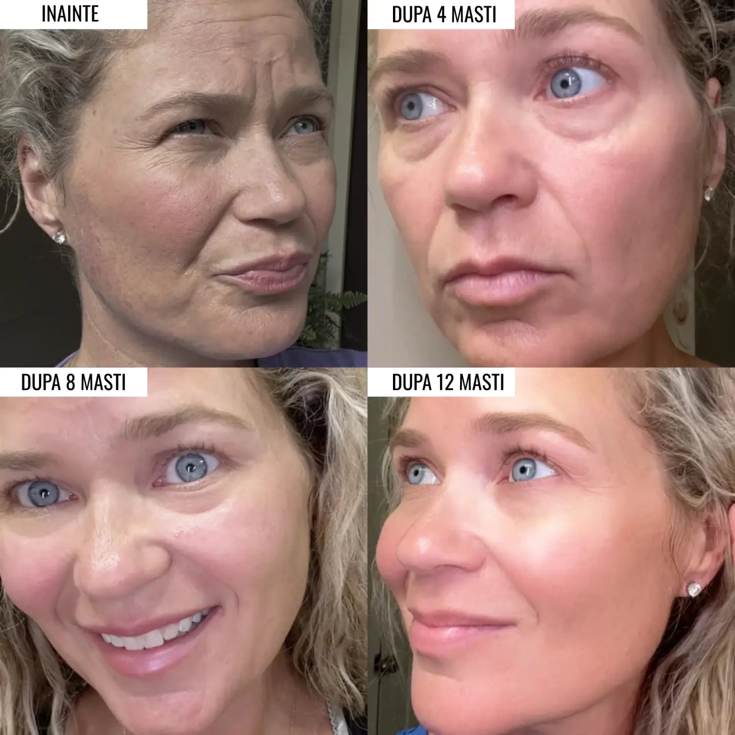 Revive Lift Face Masks